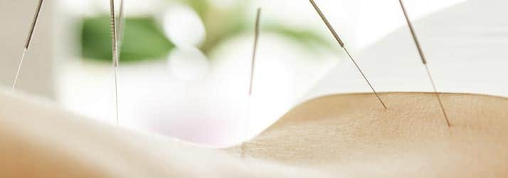 Chiropractic Columbia MO Acupuncture for Back Pain Chiropractic Columbia MO Acupuncture for Back Pain
