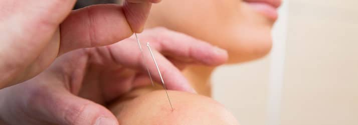 Chiropractic Columbia MO Understanding Acupuncture